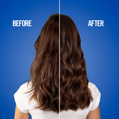 UNIQONETM HAIR TREATMENT LIMITED EDITION